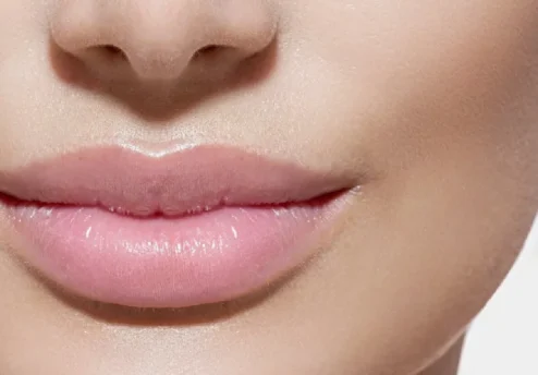 Lip Fillers