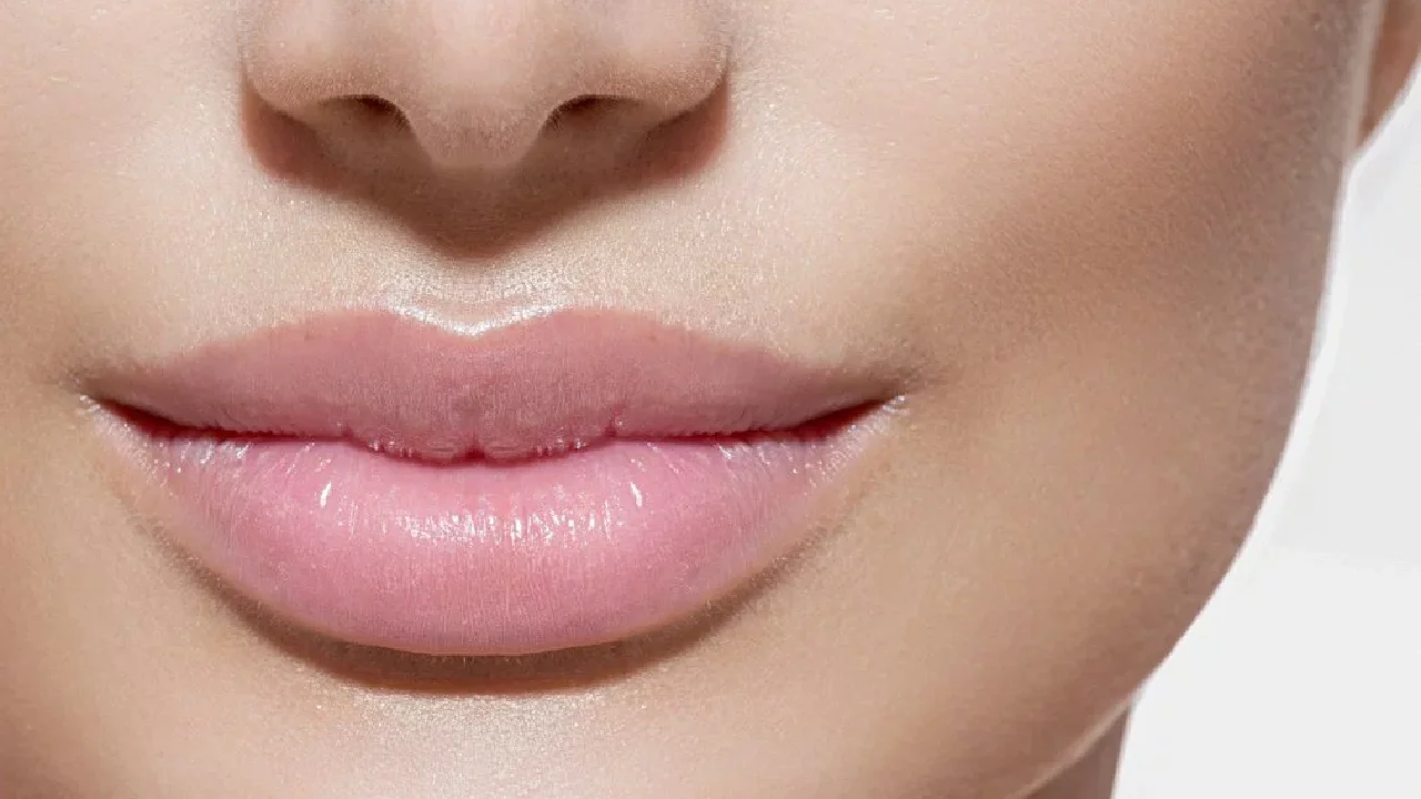 Lip Fillers