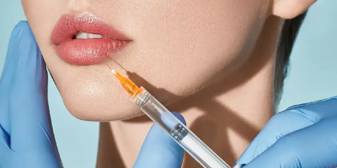 Lip Filler